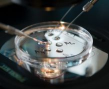 In-Vitro: IVF and IVF Cost