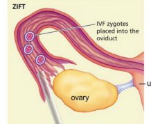 Gift and Zift