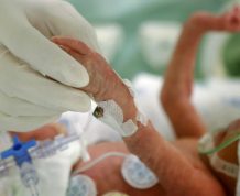 What are the Causes of Premature Birth?